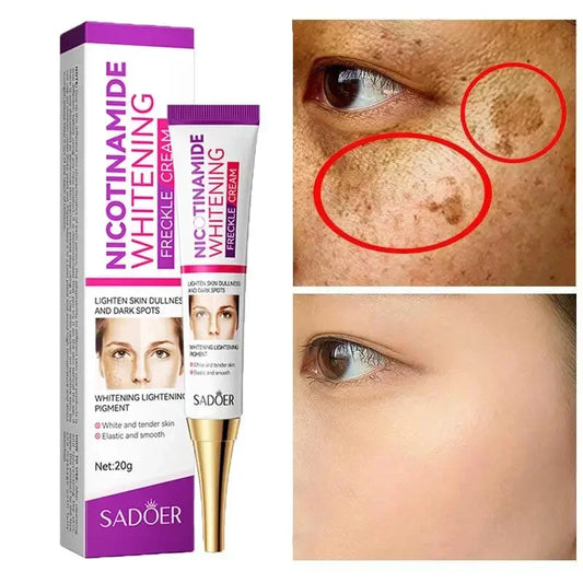 Niacinamide Whitening Freckle Cream Effectively Removes Melasma Lightens Black Spots Acne Marks Brightens Skin Care Face Cream